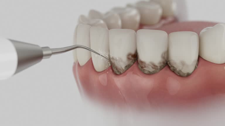 Trusted Teeth Cleaning And Checkup service in Durant, MS - Dentist Open Now